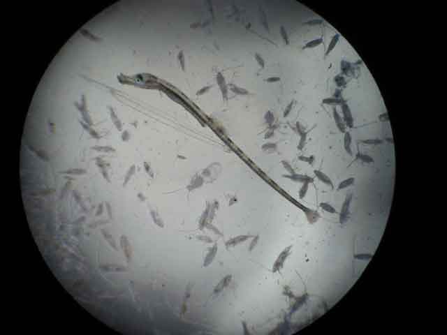 Plankton Sample 1