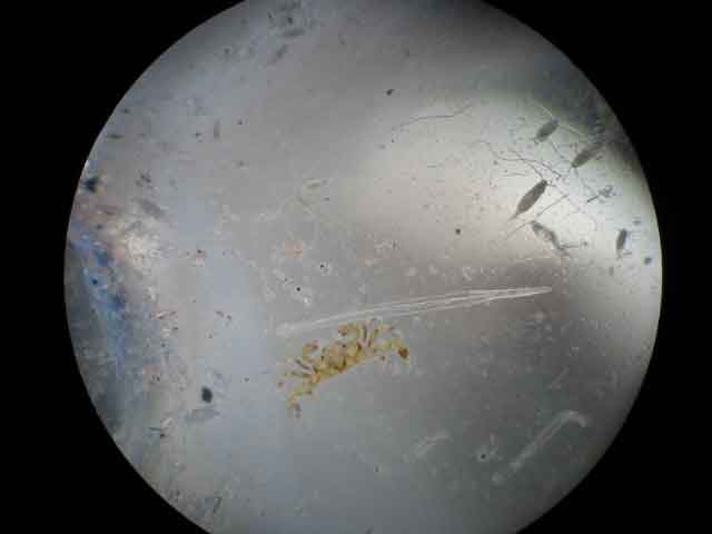 Plankton Sample 2